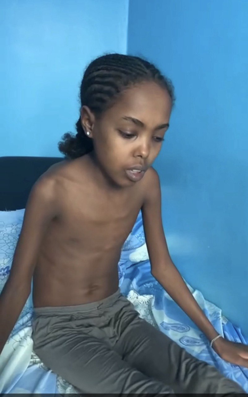 SHUMIMA – HVE 12th Patient